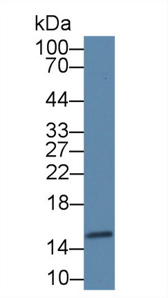 Polyclonal Antibody to Fatty Acid Binding Protein 4 (FABP4)