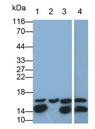 Polyclonal Antibody to Fatty Acid Binding Protein 4 (FABP4)