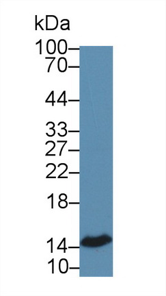 Polyclonal Antibody to Fatty Acid Binding Protein 4 (FABP4)