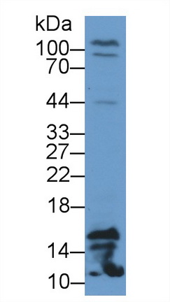 Polyclonal Antibody to Fatty Acid Binding Protein 4 (FABP4)