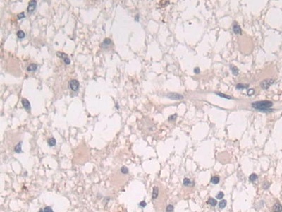 Polyclonal Antibody to Interleukin 25 (IL25)