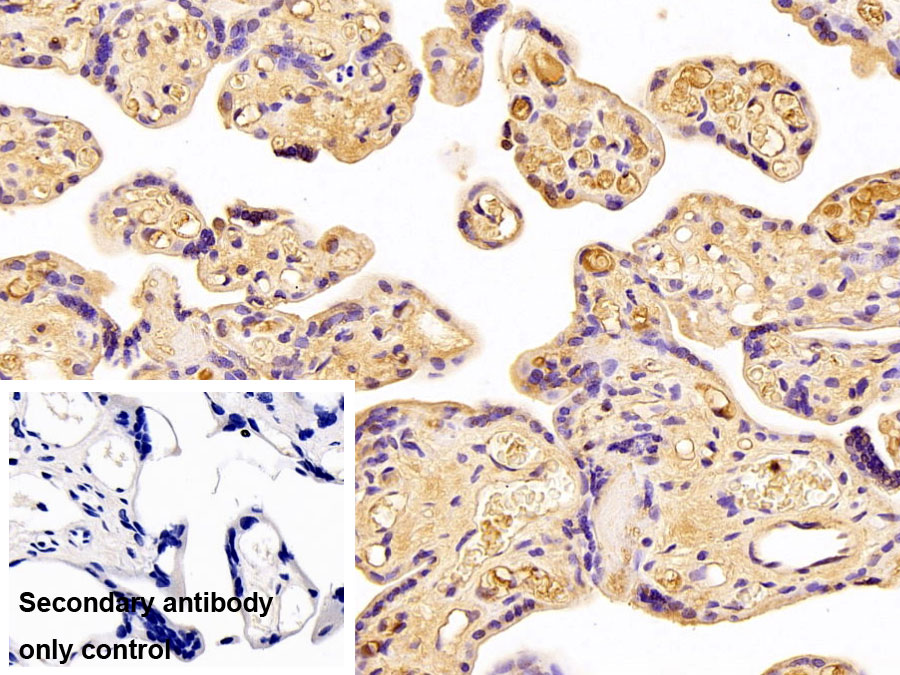 Polyclonal Antibody to Alpha-1-Antitrypsin (a1AT)