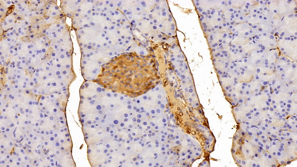 Polyclonal Antibody to Alpha-1-Antitrypsin (a1AT)