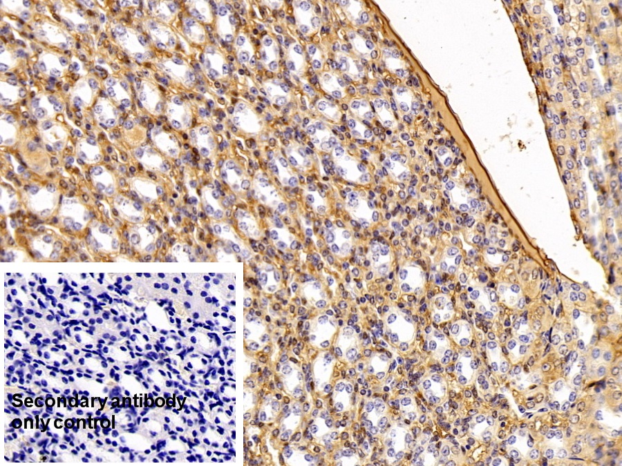 Polyclonal Antibody to Alpha-1-Antitrypsin (a1AT)