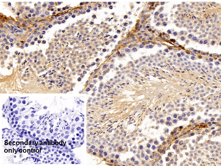 Polyclonal Antibody to Alpha-1-Antitrypsin (a1AT)