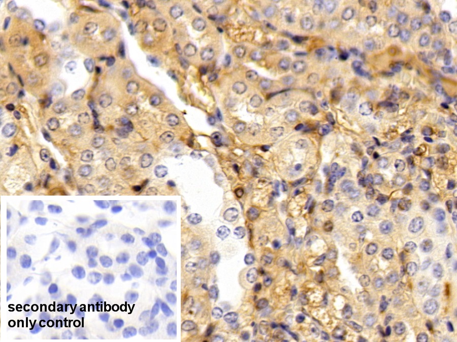 Polyclonal Antibody to Alpha-1-Antitrypsin (a1AT)