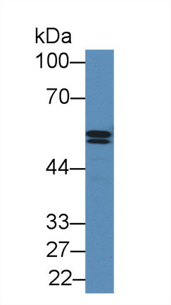 Polyclonal Antibody to Alpha-1-Antitrypsin (a1AT)