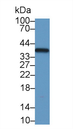 Polyclonal Antibody to Lactate Dehydrogenase B (LDHB)