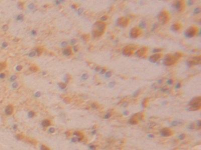 Polyclonal Antibody to Lactate Dehydrogenase B (LDHB)