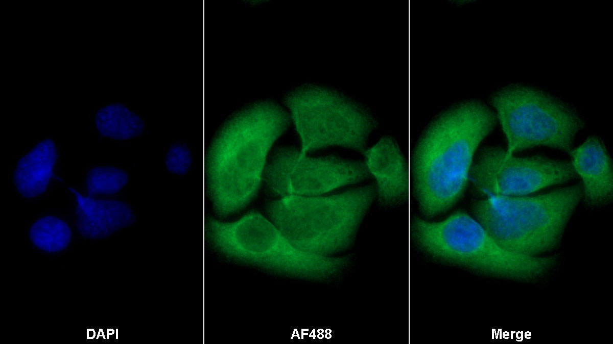 Polyclonal Antibody to Lactate Dehydrogenase B (LDHB)