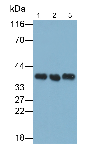 Polyclonal Antibody to Lactate Dehydrogenase B (LDHB)