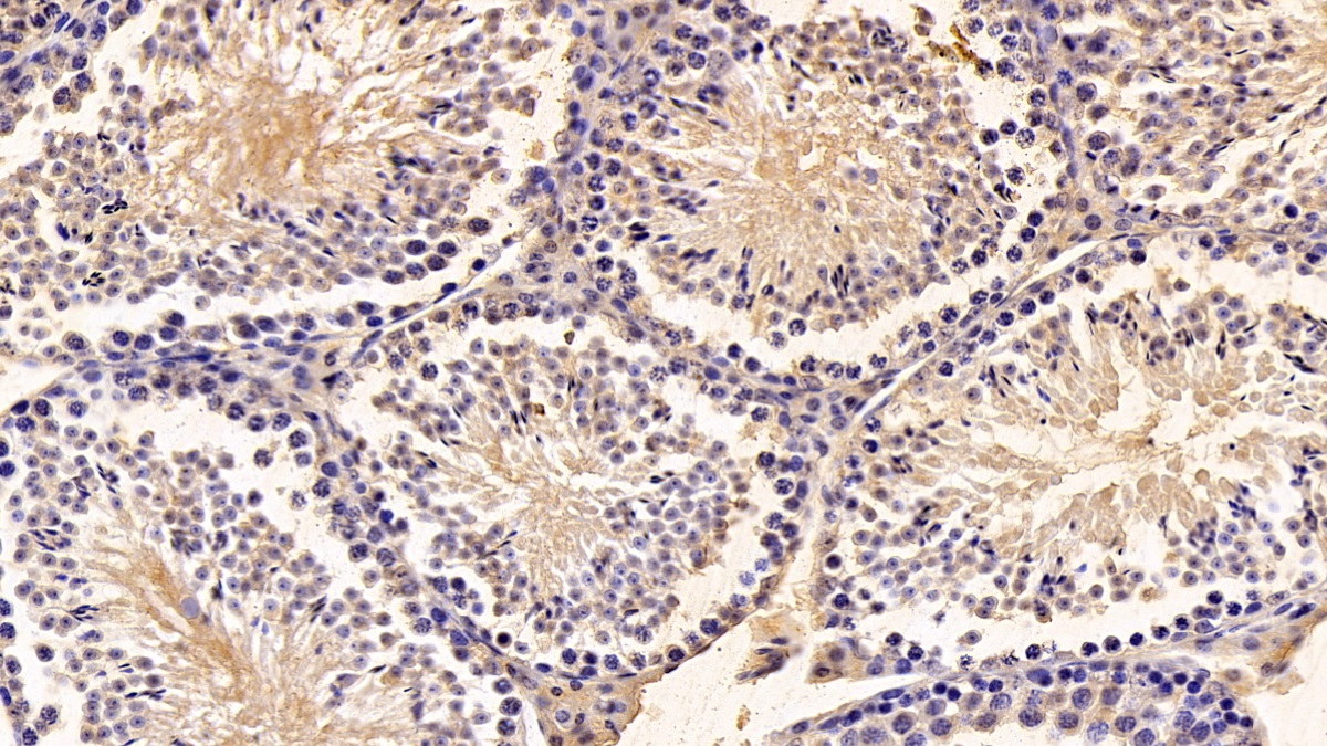 Polyclonal Antibody to Angiopoietin Like Protein 3 (ANGPTL3)