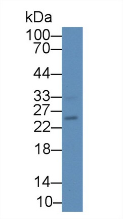 Polyclonal Antibody to Interleukin 17B (IL17B)