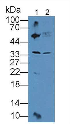 Polyclonal Antibody to TATA Binding Protein (TBP)