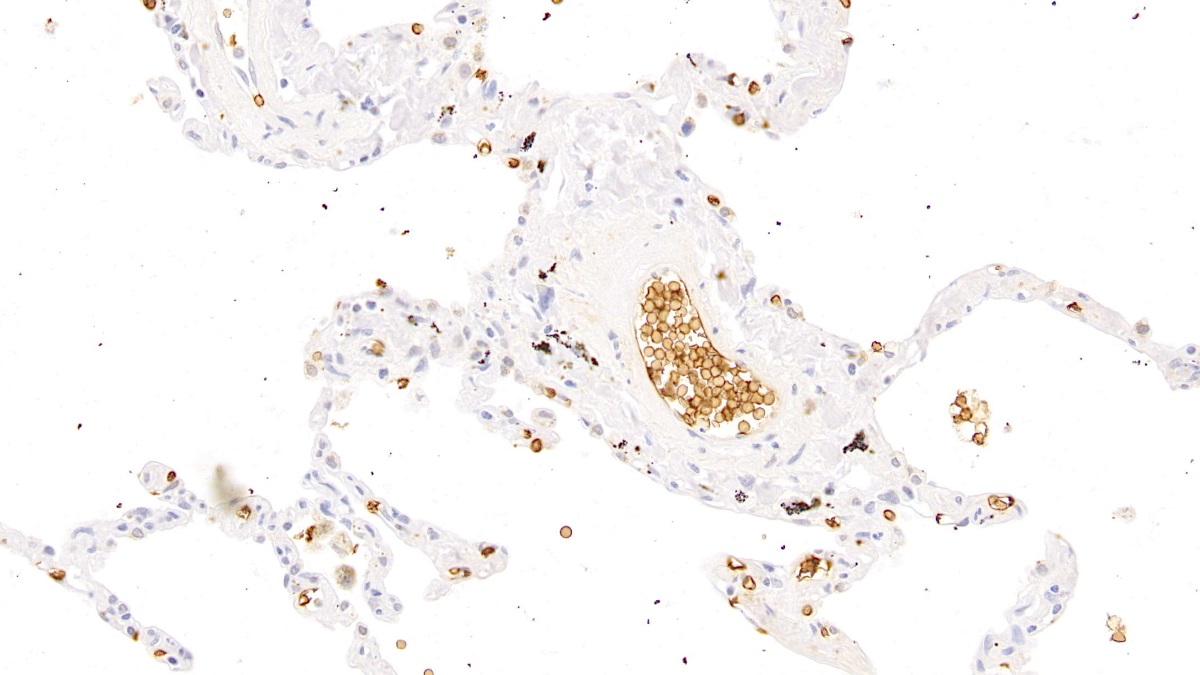 Polyclonal Antibody to Glycophorin A (GYPA)