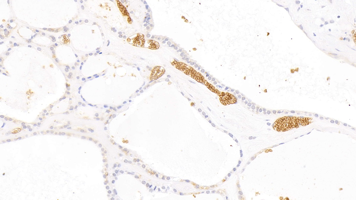 Polyclonal Antibody to Glycophorin A (GYPA)