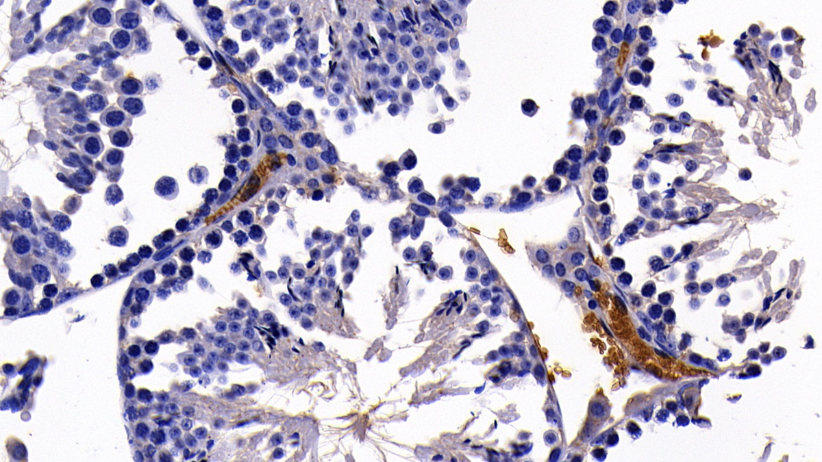 Polyclonal Antibody to Glycophorin A (GYPA)