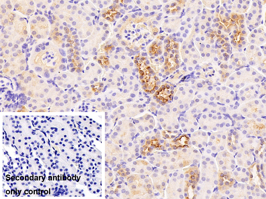 Polyclonal Antibody to Myeloid Differentiation Factor 88 (MyD88)