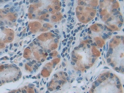 Polyclonal Antibody to Myeloid Differentiation Factor 88 (MyD88)