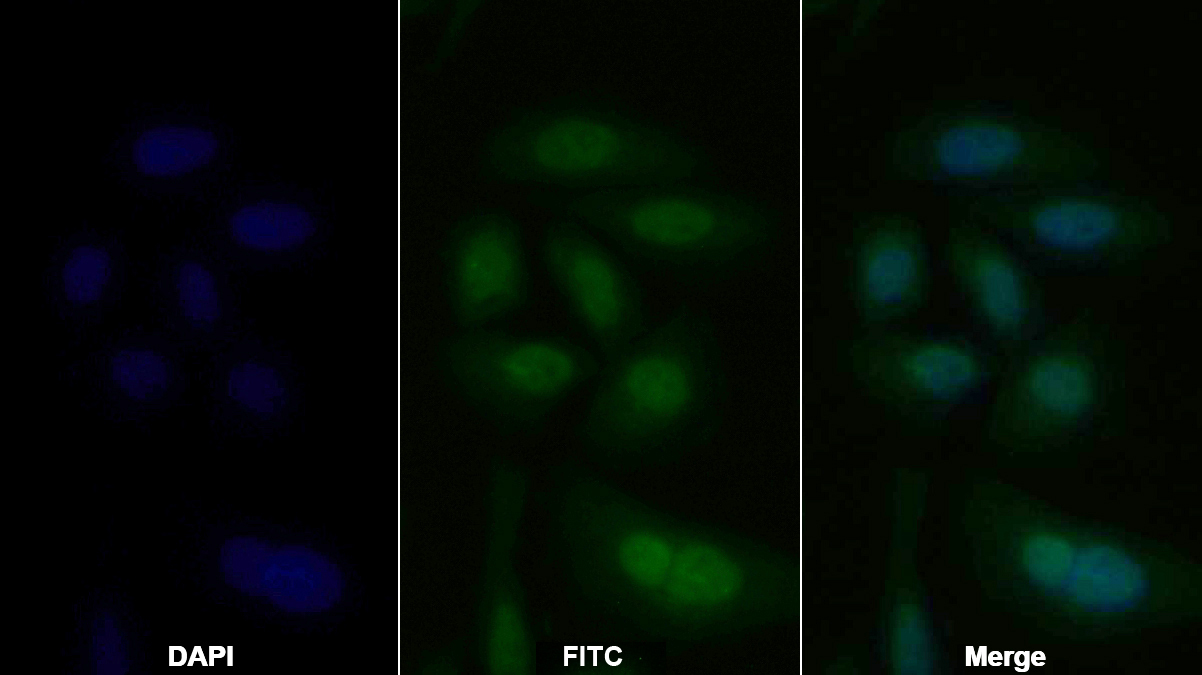 Polyclonal Antibody to Myeloid Differentiation Factor 88 (MyD88)