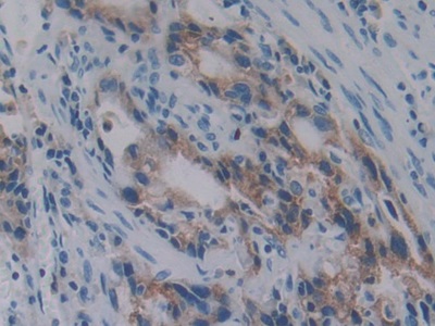 Polyclonal Antibody to Protein Kinase B Beta (PKBb)