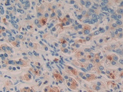 Polyclonal Antibody to Serum/Glucocorticoid Regulated Kinase 2 (SGK2)