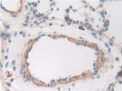 Polyclonal Antibody to Cluster Of Differentiation (CD163)