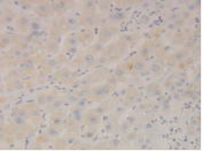 Polyclonal Antibody to Signal Transducer And Activator Of Transcription 3 (STAT3)