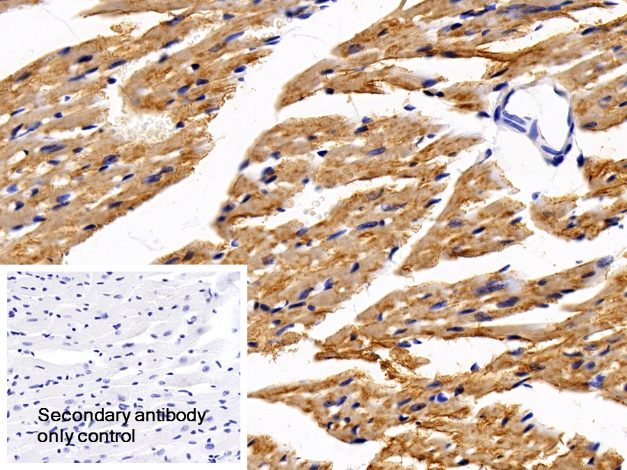 Polyclonal Antibody to Signal Transducer And Activator Of Transcription 3 (STAT3)