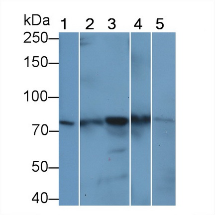 Polyclonal Antibody to Signal Transducer And Activator Of Transcription 3 (STAT3)