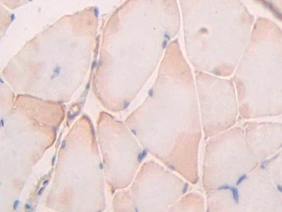 Polyclonal Antibody to Ubiquitin D (UBD)