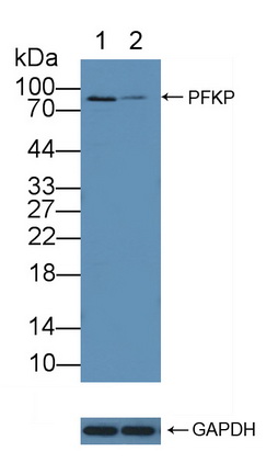 Polyclonal Antibody to Phosphofructokinase, Platelet (PFKP)