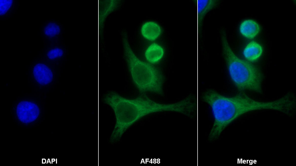 Polyclonal Antibody to Phosphofructokinase, Platelet (PFKP)