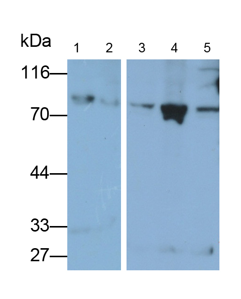 Polyclonal Antibody to Phosphofructokinase, Platelet (PFKP)