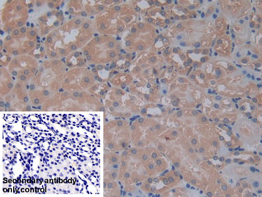 Polyclonal Antibody to Phosphofructokinase, Platelet (PFKP)