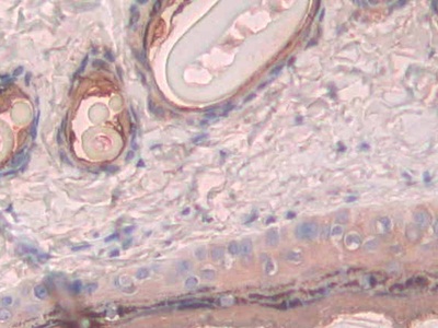 Polyclonal Antibody to Phosphofructokinase, Platelet (PFKP)