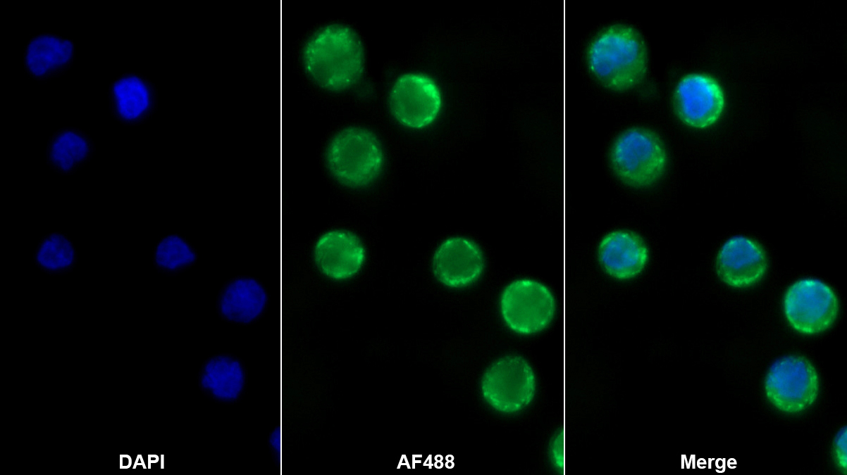 Polyclonal Antibody to Hexokinase 3, White Cell (HK3)