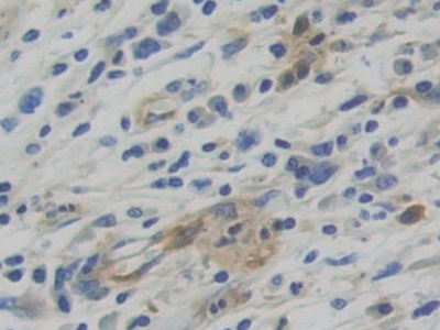 Polyclonal Antibody to Tryptophanyl tRNA Synthetase (WARS)