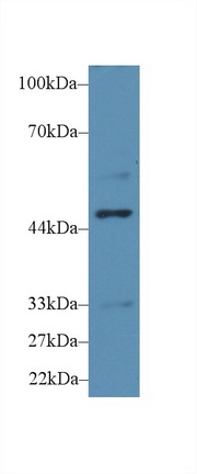 Polyclonal Antibody to Tryptophanyl tRNA Synthetase (WARS)