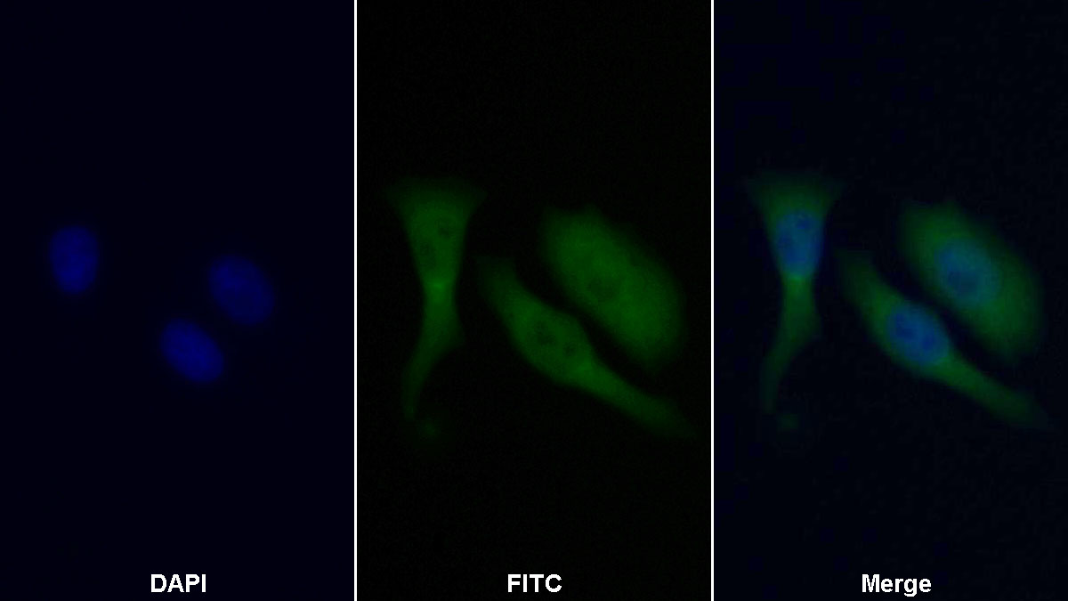 Polyclonal Antibody to Tryptophanyl tRNA Synthetase (WARS)