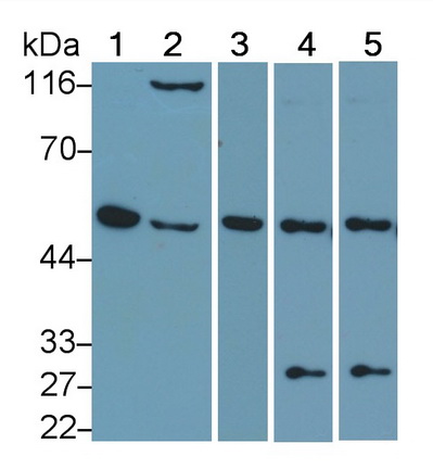 Polyclonal Antibody to Interferon Regulatory Factor 4 (IRF4)