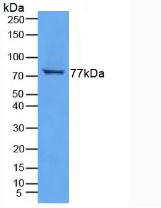 Polyclonal Antibody to Transglutaminase 3, Epidermal (TGM3)