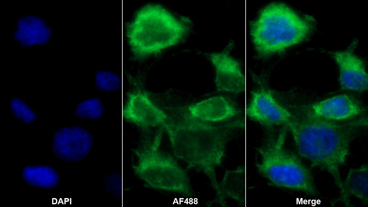 Polyclonal Antibody to Transglutaminase 3, Epidermal (TGM3)