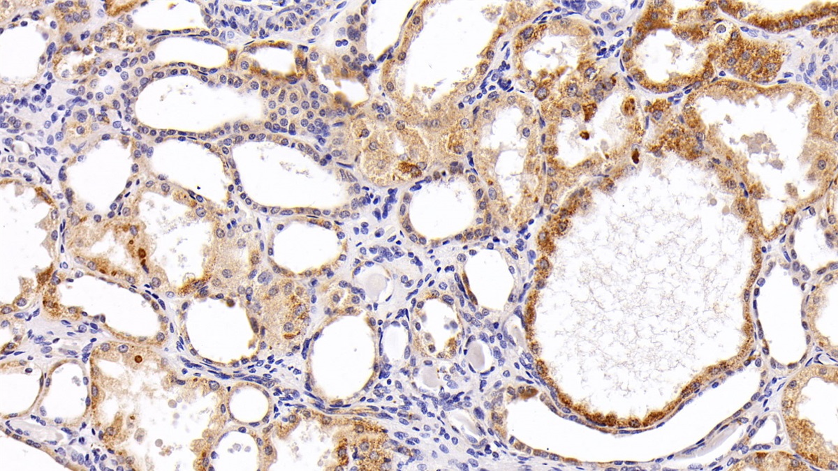 Polyclonal Antibody to Ribonuclease A3 (RNASE3)