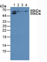 Polyclonal Antibody to Hydroxymethylglutaryl Coenzyme A Synthase (HMGCS)