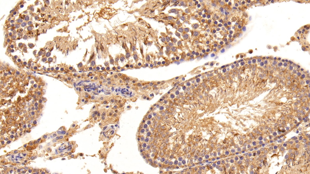 Polyclonal Antibody to Inhibin Beta B (INHbB)