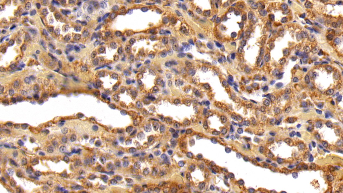 Polyclonal Antibody to Inhibin Beta B (INHbB)