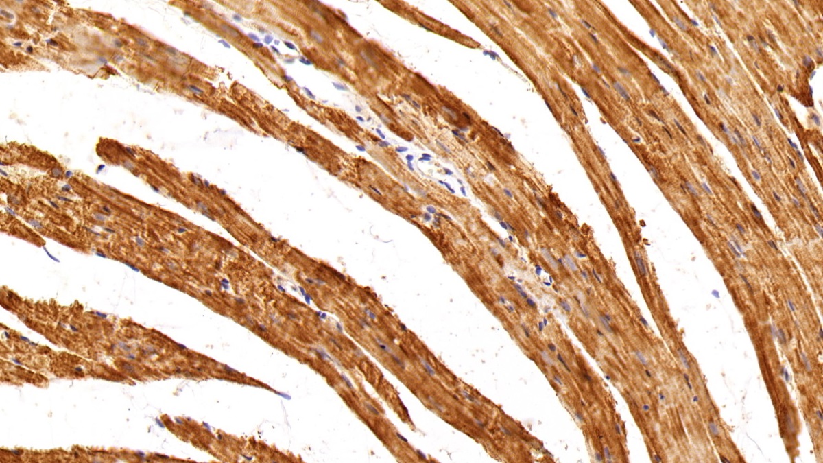 Polyclonal Antibody to Inhibin Beta B (INHbB)