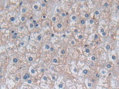 Polyclonal Antibody to Lectin Galactoside Binding, Soluble 3 Binding Protein (LGALS3BP)