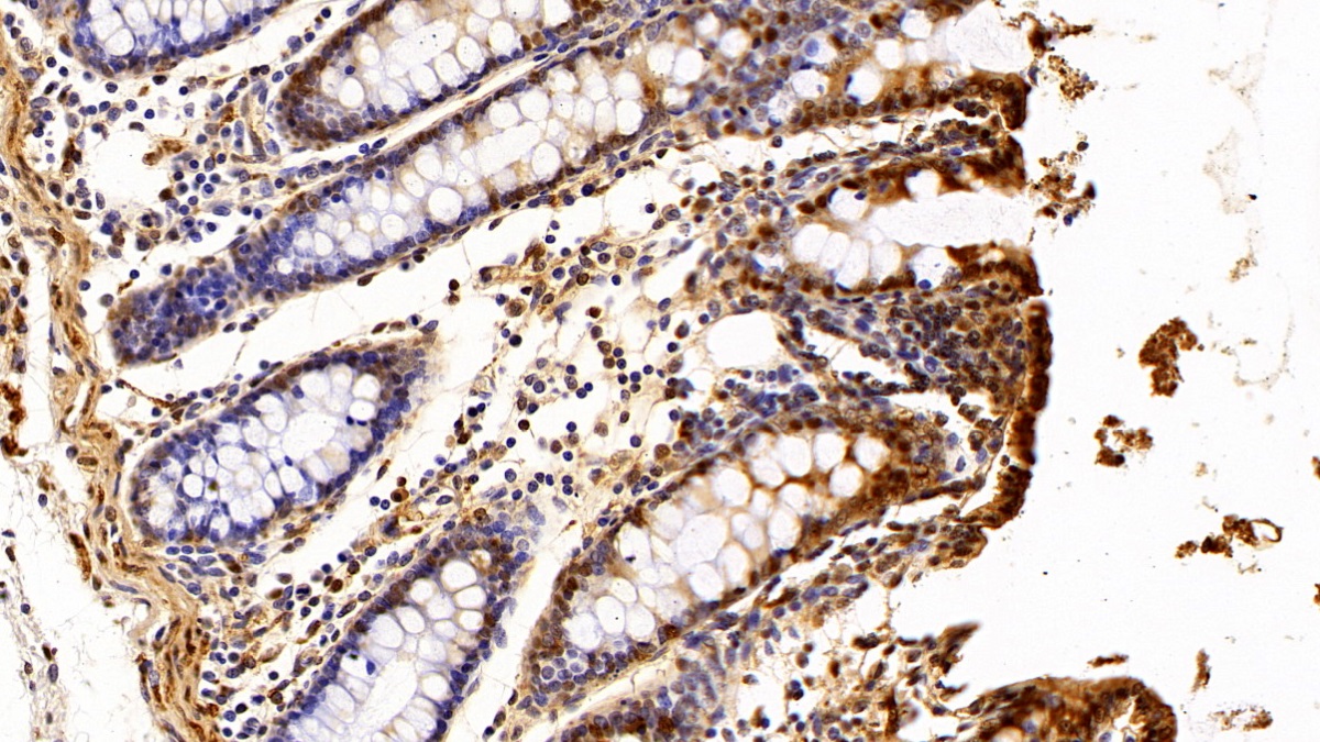 Polyclonal Antibody to S100 Calcium Binding Protein A6 (S100A6)